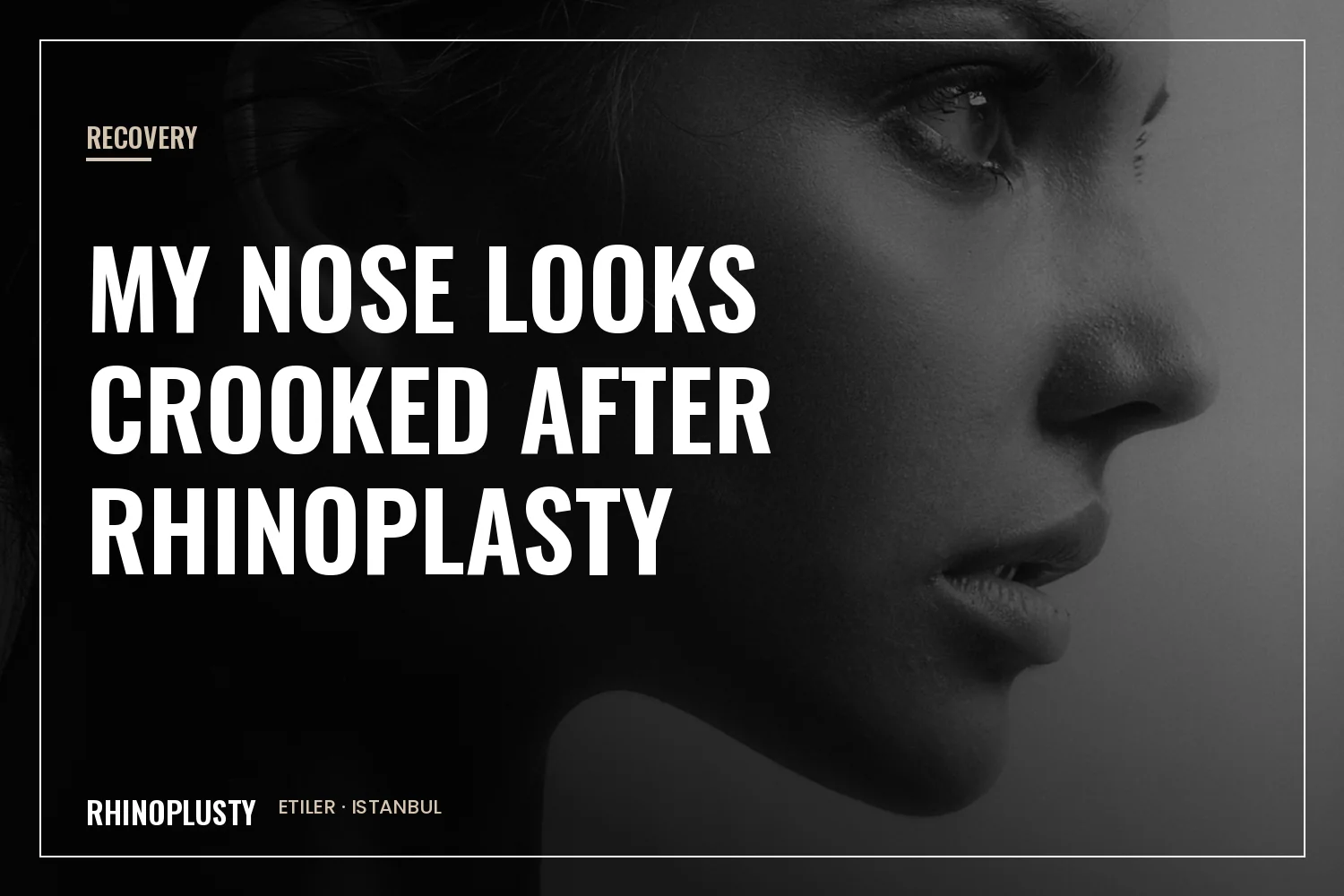 Profile view of an elegant woman face and delicate nose line