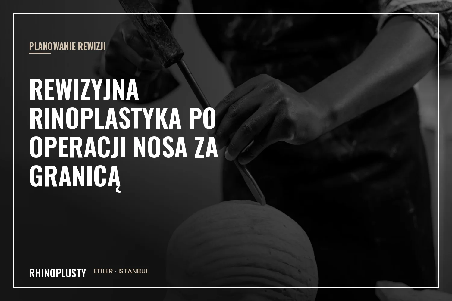 Profil klasycznej rzeźby nosa obok notatek medycznych dotyczących planowania rewizji