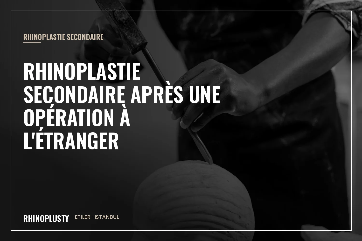 Profil d'une sculpture de nez classique à côté de notes médicales pour une reprise