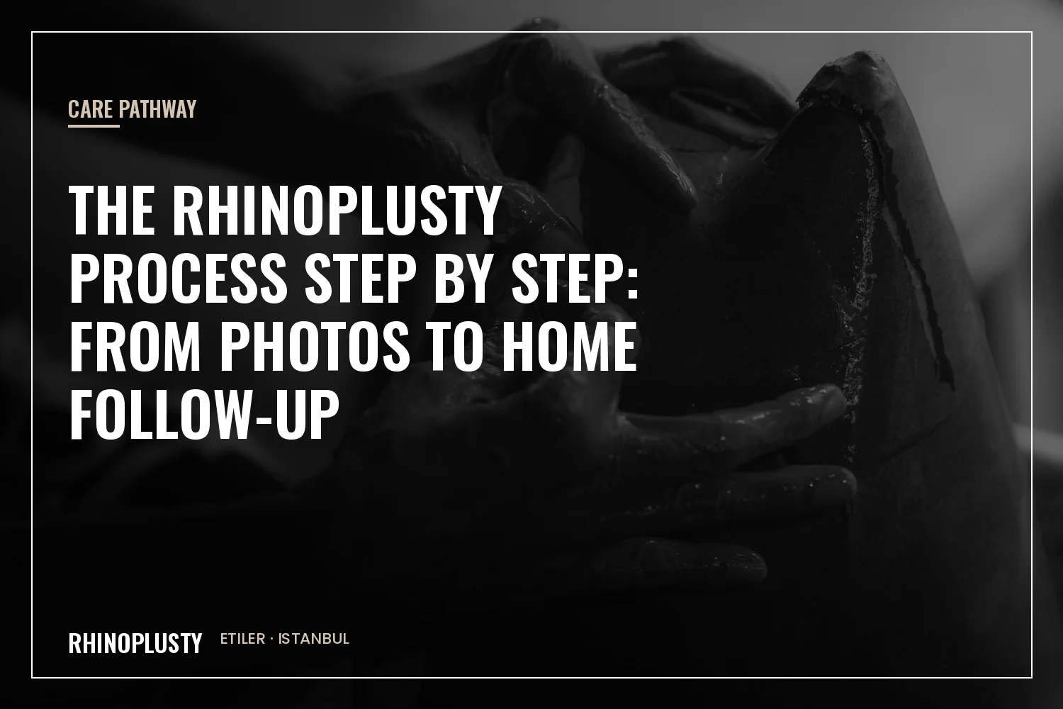 The Rhinoplusty care pathway from planning to follow-up